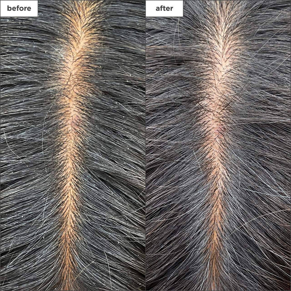 Briogeo Scalp Revival Charcoal + Tea Tree Cooling Hydration Mask for Dry, Itchy Scalp - G13 - 1785